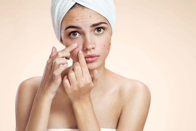 Extraction Facials