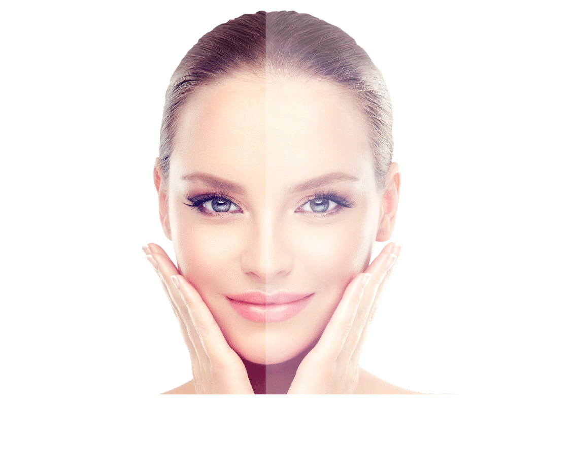 NEOGEN nitrogen plasma treatment