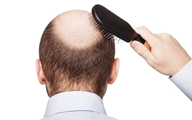 hair loss
